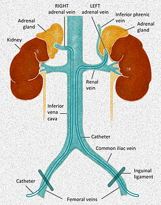 Illustration of kidneys, adrenal glands, and important veins