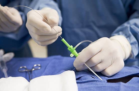 Radiologist inserting catheter